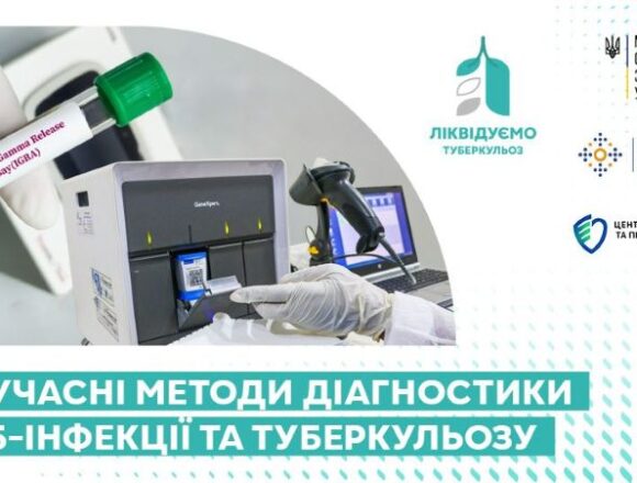 З квітня в Україні впроваджують нові тести на туберкульоз